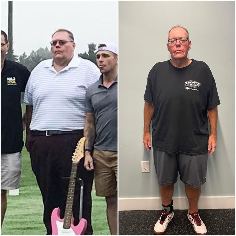 Kevin L. before and after